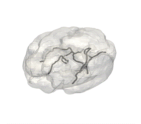 Xray Flurescence